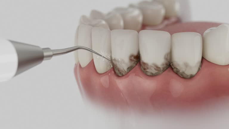 Reliable Dental contractor in Wacousta, MI by Dentist Open Now